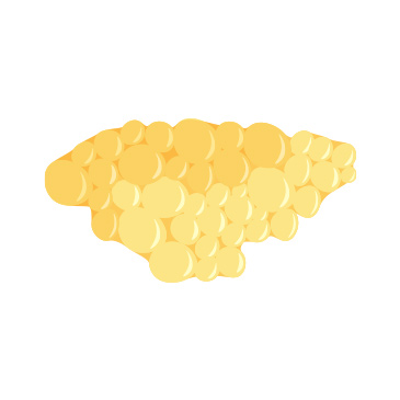 지방이식 후 변성 조직