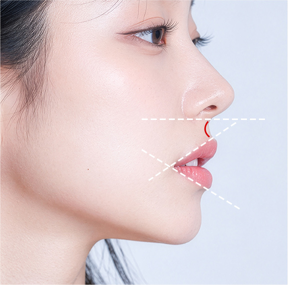 인중오목술 측면